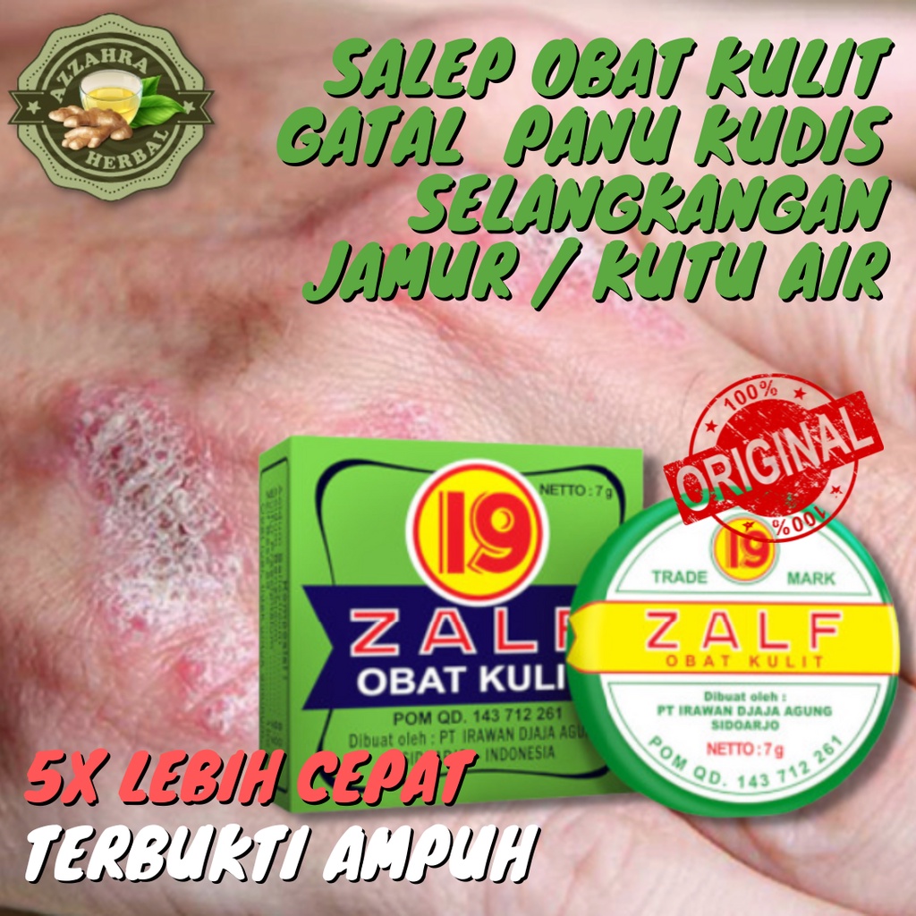 Salep Kulit Gatal Kurap Panu Selangkangan Gudik Dijamin Ampuh / Zudaifu / Salep KL / Zalf Obat Kulit 19