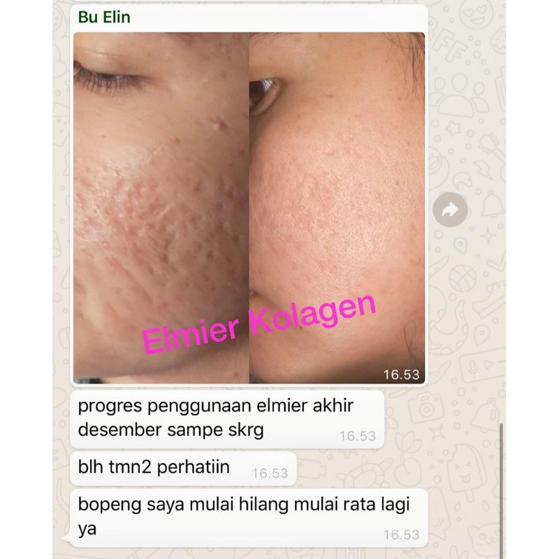ELMIER COLLAGEN (free liptint)
