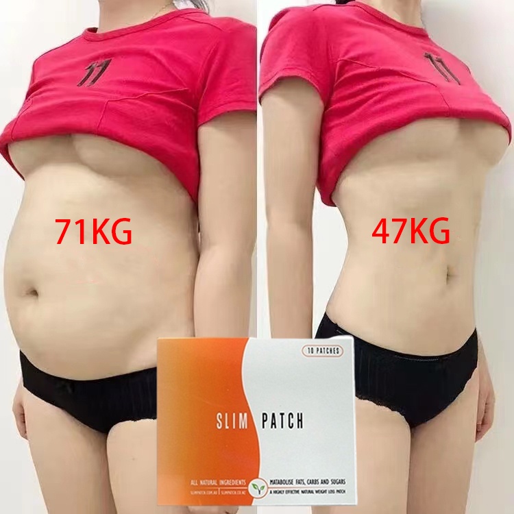 Slim patch koyo pelangsing ori  Pembakar Lemak 10PCS Burn fat fast Belly Button Sticker Detox Magnet