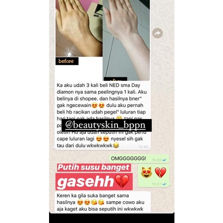 TESTI HB UNGU BEAUTYSKIN