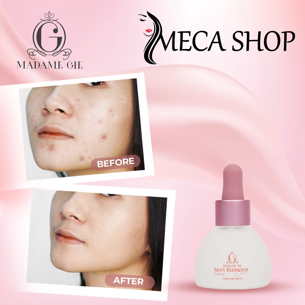 Madame Gie Skin Barrier Radience Face Serum 5% Niacinamide | Moisturizer | Cream | Facial Wash | Face Oil - Skincare Pelembab