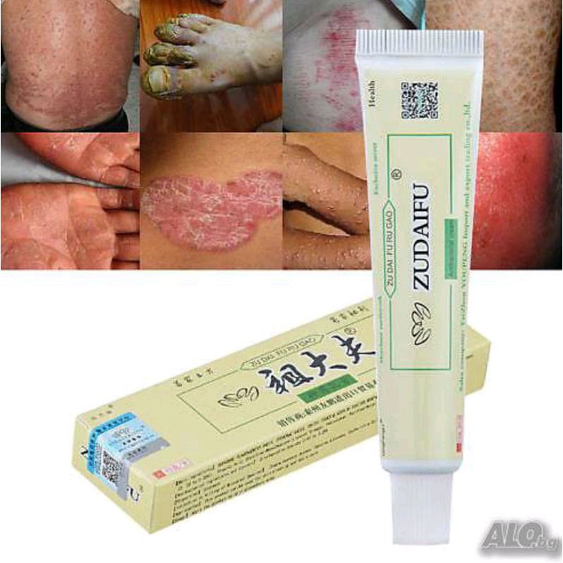 OBAT Gatal eksim Psoriasis Jerawat Ruam Jamur Kudis Kurap Kutu Air Beri