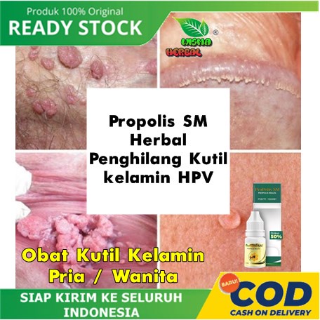 Obat Propolis SM Herbal Penghilang Kutil kelamin HPV, Kutil Kelamin Pria / Wanita | Obat Penyakit Ke