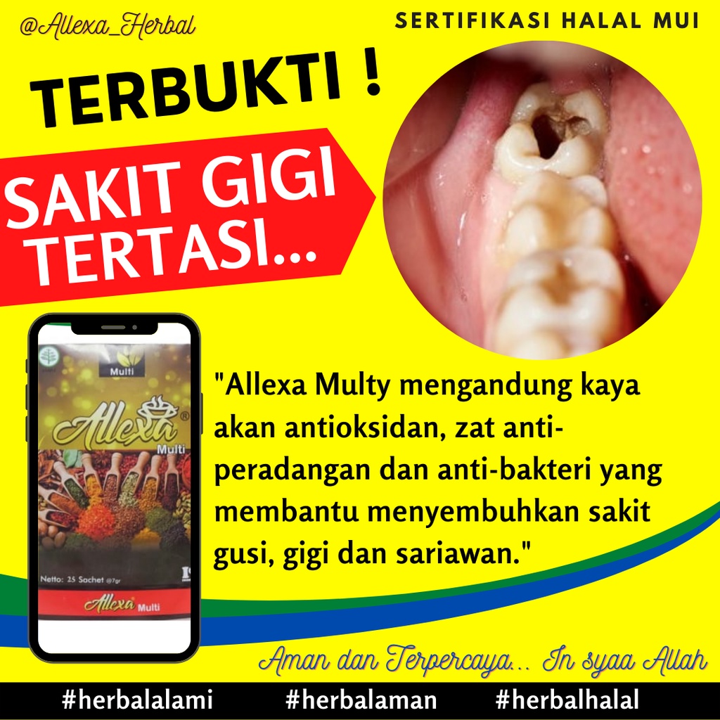 ALLEXA MULTY - Obat Sakit Gigi - Gigi Berlubang - Gusi Bengkak Ampuh Allexa Multy Amazing Obat Sakit