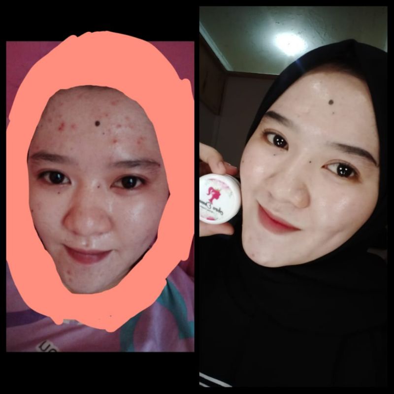 skincare aura super whitening terviral