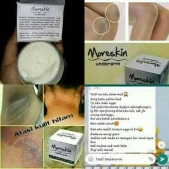 Moreskin underarm