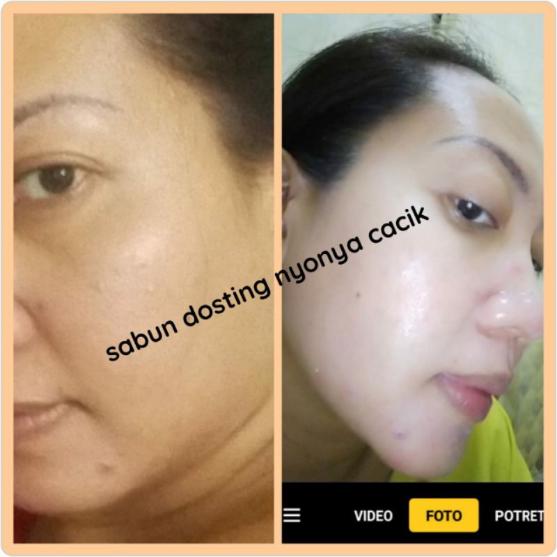 sabun dosting nyonya cacik + spf UV