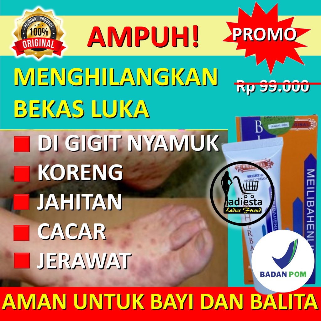 Penghilang Bekas Jerawat Menghilangkan Bekas Jerawat Hitam