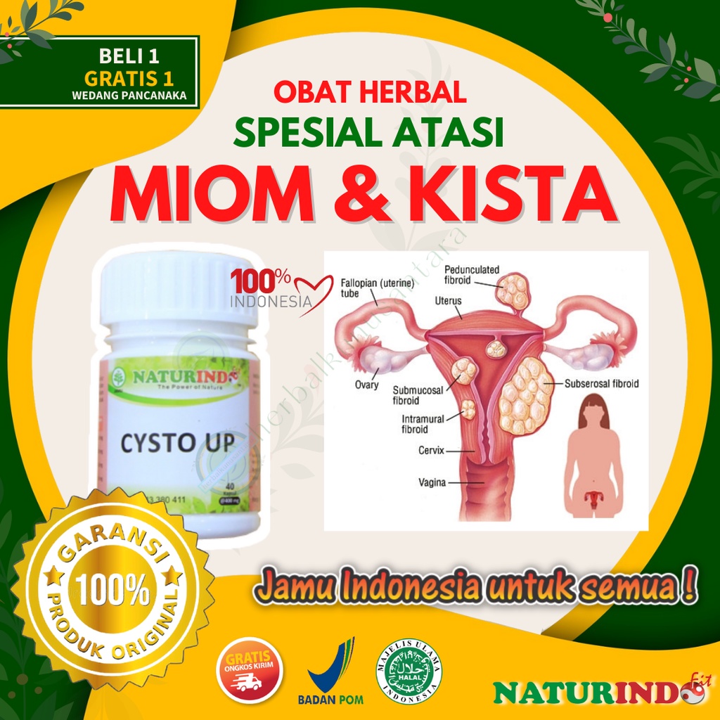 Jual Obat Miom Dan Kista Ovarium Kista Bartholin Kista Ganglion Herbal ...