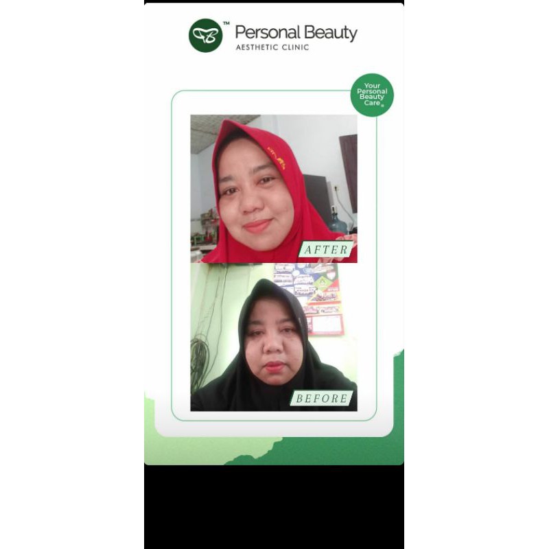 Cream Malam 1AS by Personal Beauty