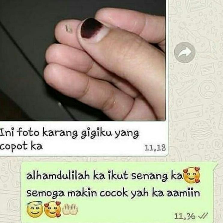 ✤ ()odol /odol /orecare /orecare /super whitening/orecare/pasta gigi terbaik ♖