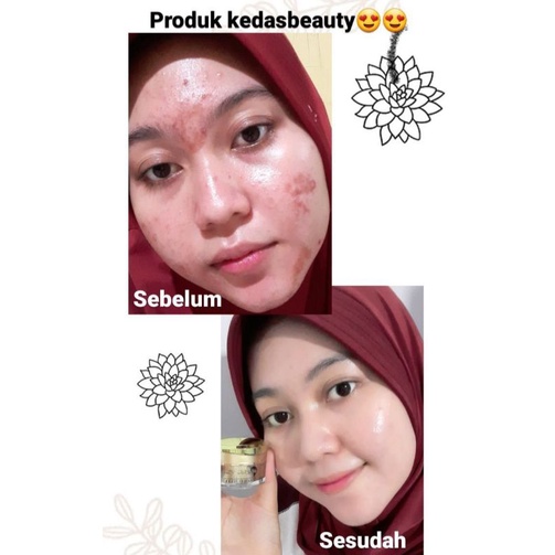 {COD} SABUN ASLI - GOLD JELLY - BODY SERUM KEDAS BEAUTY ORIGINAL