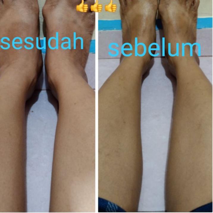 READY|Lulur| |AGEN BEDDA LOTONG ORI VELLS BEAUTY | lulur velis | bedda lotong velis |beda lotong