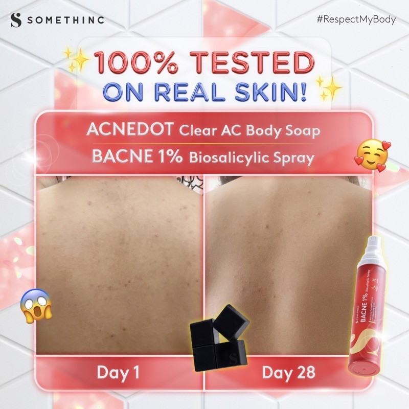 SOMETHINC Acnedot Clear AC Body Soap