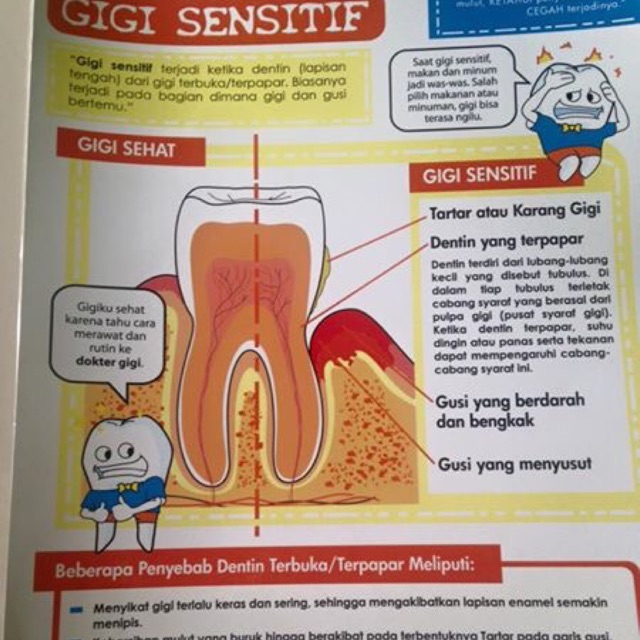 

PAKET POSTER EDUKASI gigi. UK A3 (30x42cm) terdiri dari 11 judul