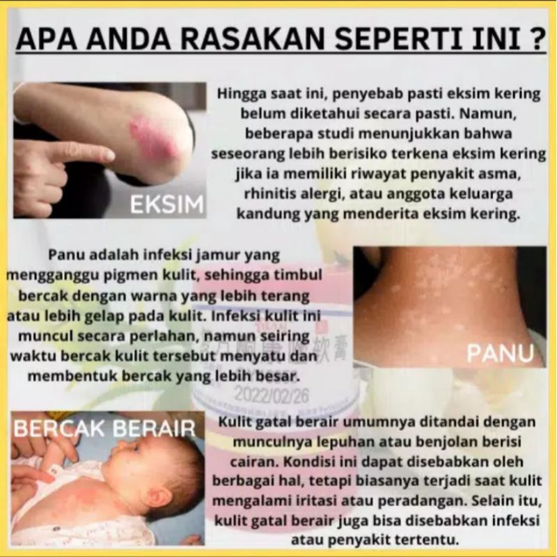 1 pi kang wang salep original salep gatal paling ampuh kulit obat panu saleb gatel alergi-1