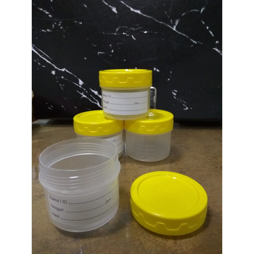 Jual Pot Urine/ Urine Container/ Tempat Sampel Urine (Uk 60 ml Sterile