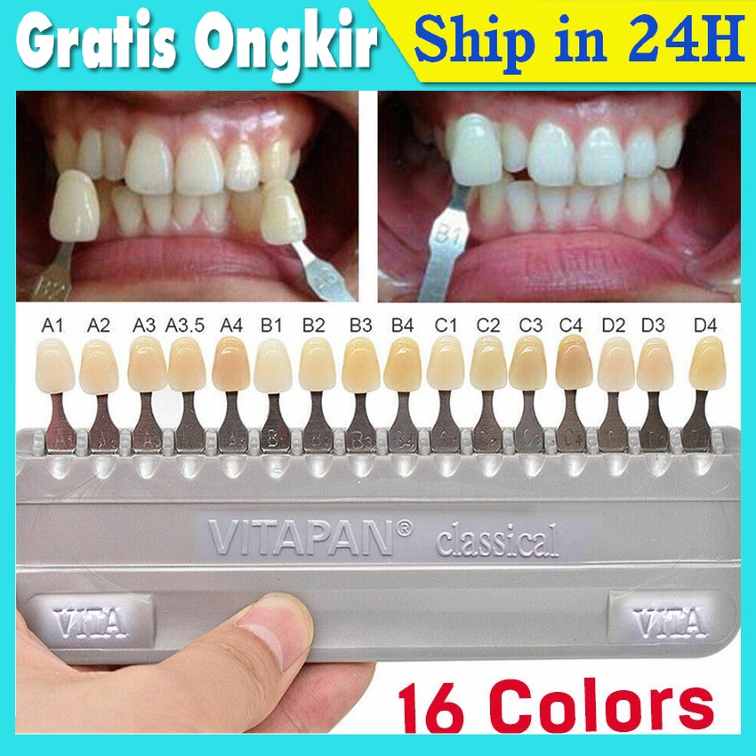 Jual Dental Bleaching Shade Guide Vita A1 D4 Acuan Warna Gigi