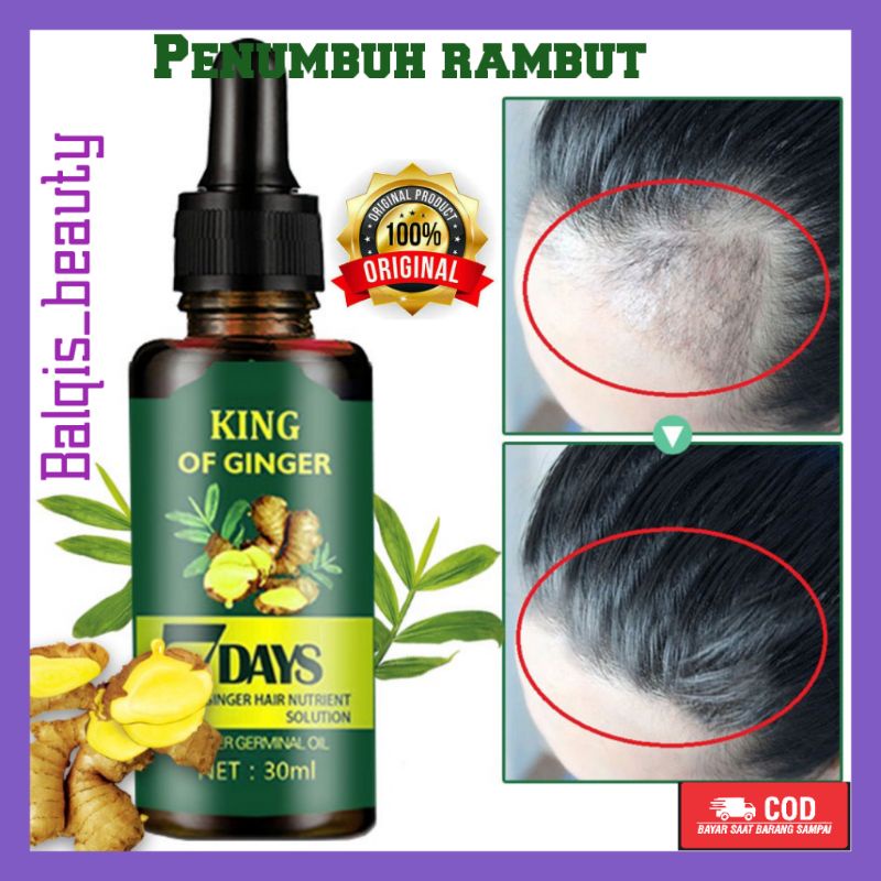 Penumbuh Rambut Rontok dan Botak