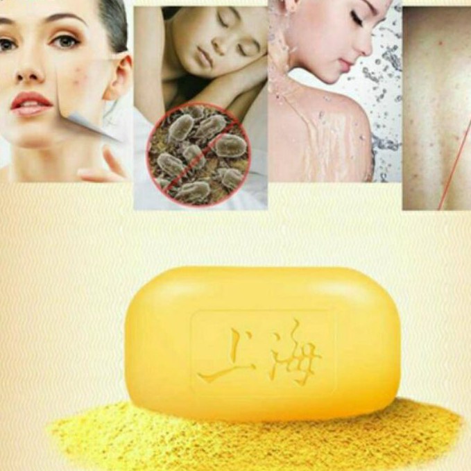 [100% Asli] Shanghai Sulfur Soap Sabun Shanghai Belerang Jerawat Anti Bakteri Gatal Jamur Kurap Kudis Panu