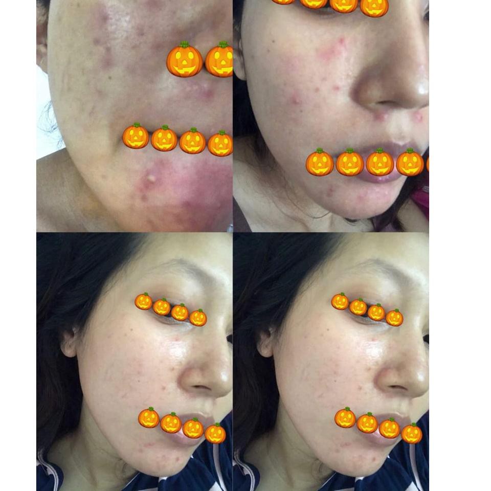 

PrdЦk kᗴkίnίΔnTONER GLOWING KEFIR KAMBING ETAWA ORGANIC |siap.Diorder|.,..,.!