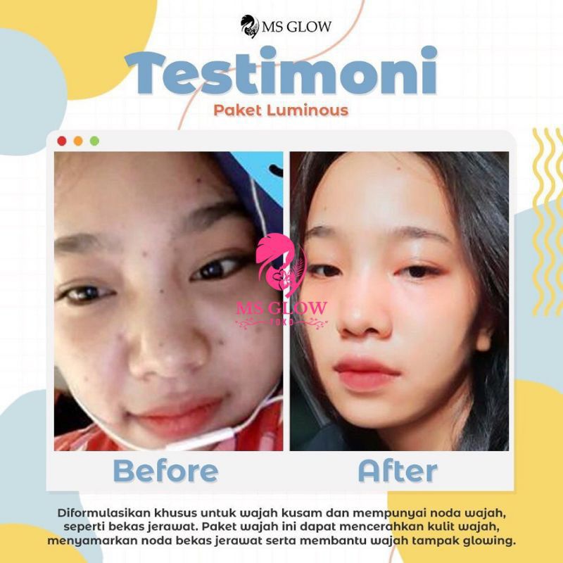 MS Glow Original Ori Luminous Series Berkualitas ber BPOM Skin Care Pemutih Wajah Berseri Termurah