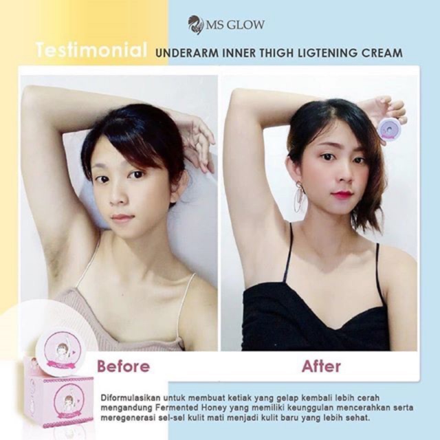 UNDERARM MSGLOW CREAM MEMUTIHKAN KETIAK DLL