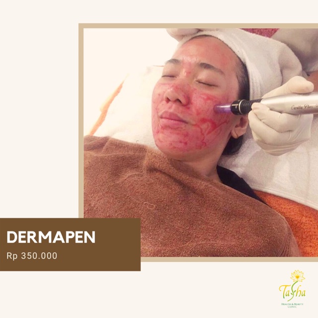 Dermaroller Dermapen