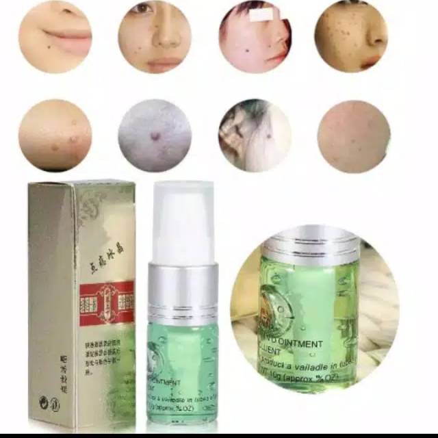 Dark Spot / Aftercare LASER DARK SPOT / Mole atau Spot Removal Aftercare