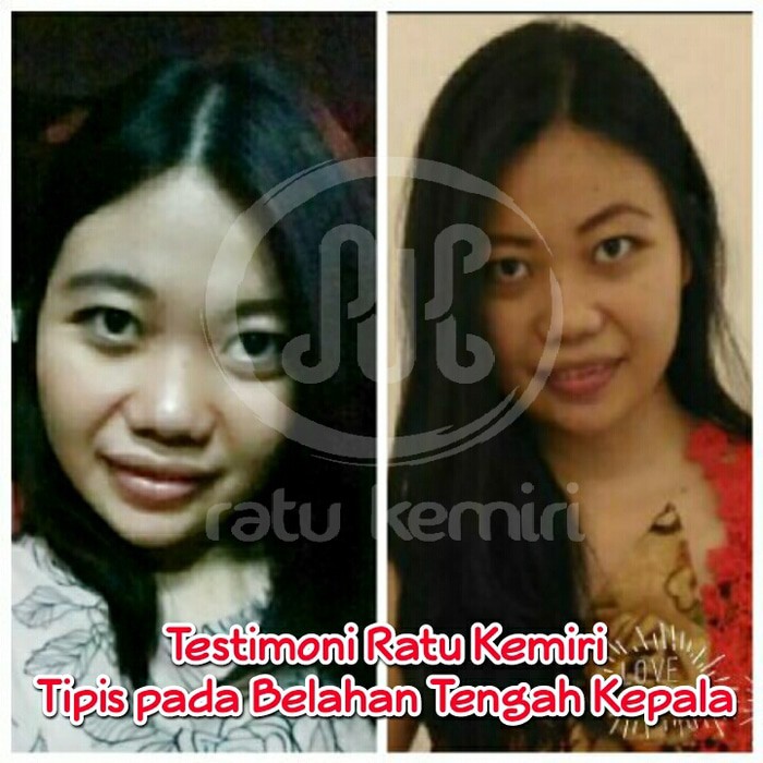 DISKON!! PAKET HEMAT PERAWATAN RAMBUT RONTOK ALAMI RATU KEMIRI STYLING RAMBUT