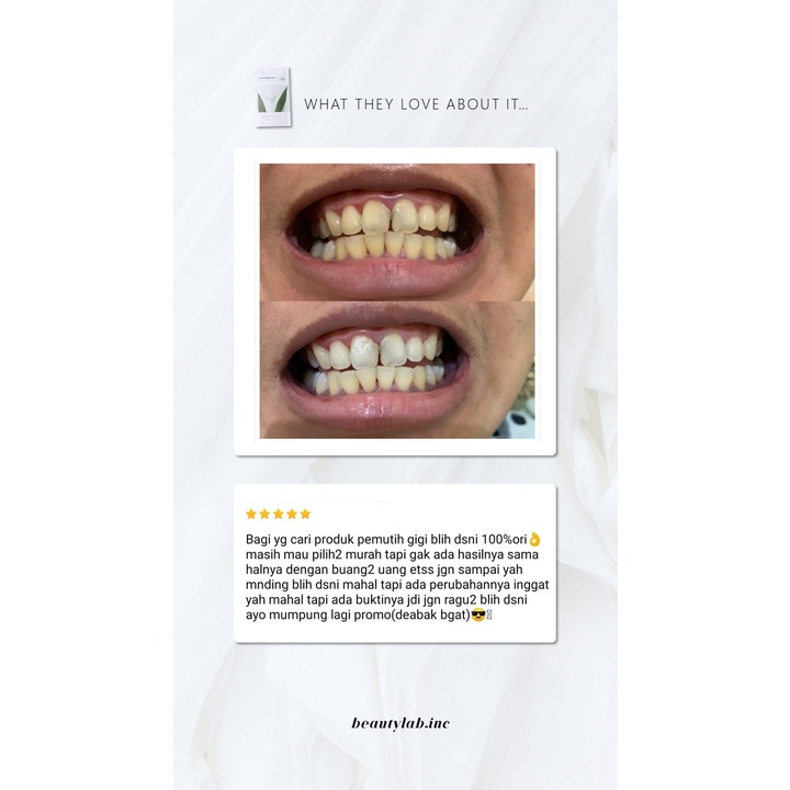 ❤️ RG ❤️ BEAUDELAB BEUDELAB NEWLAB PRO TEETH WHITENING KIT | Pemutih Gigi Permanen LED