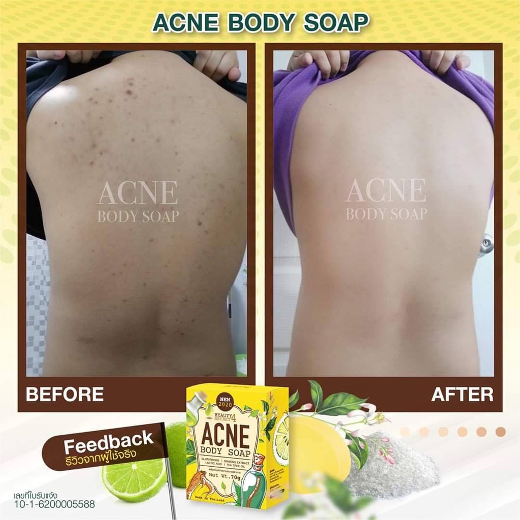 [TERMURAH] Beauty Secret Acne Body Soap | Sabun Jerawat | Jerawat Punggung Badan | Best Seller di Thailand