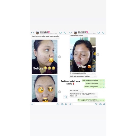 Paket Acne Colista Skin Care BPOM-2