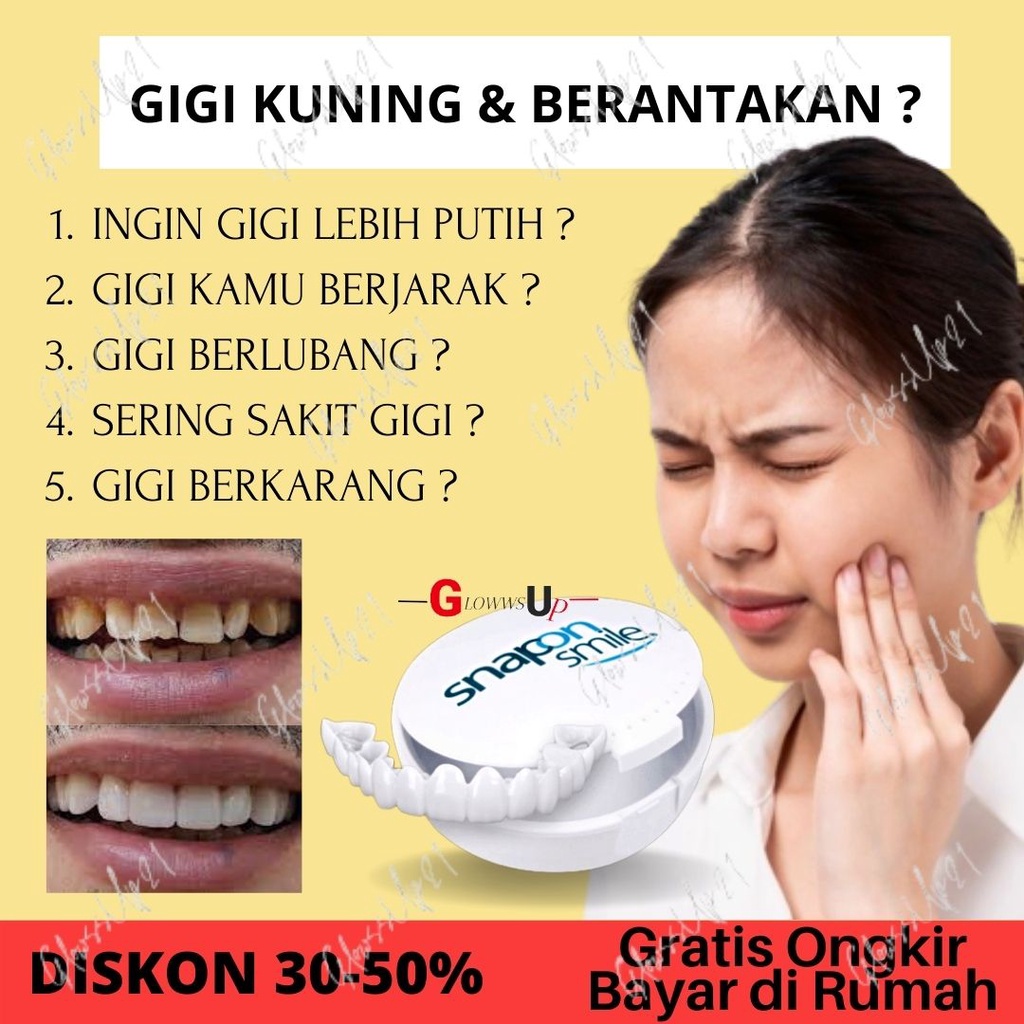 Snap On Smile 100% ORIGINAL Authentic Perawatan Kesehatan Gigi Palsu Renggang Snapon Smile 1 Set