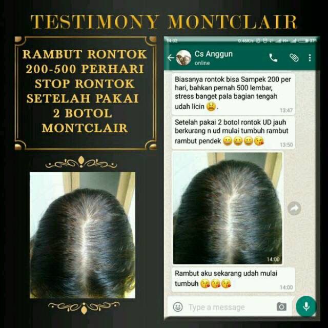 Montclair Hair Serum ORIGINAL 100% Penumbuh Rambut Bergaransi Best Seller Produk