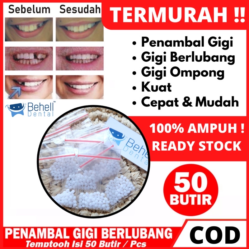 TER MURAH !! 600 BUTIR TEMPTOOTH GIGI PALSU SEMENTARA PENAMBAL GIGI PATAH RENGGANG / TEMTOOTH / BAHAN TAMBAL GIGI BOLONG BERLUBANG / TEMPORARY TOOTH INSTAN PRAKTIS / TEMPTOOTH GINGSUL PATAH LEM ORIGINAL ISI 600 / 500 / 400 / 300 / 200 / 100 BUTIR