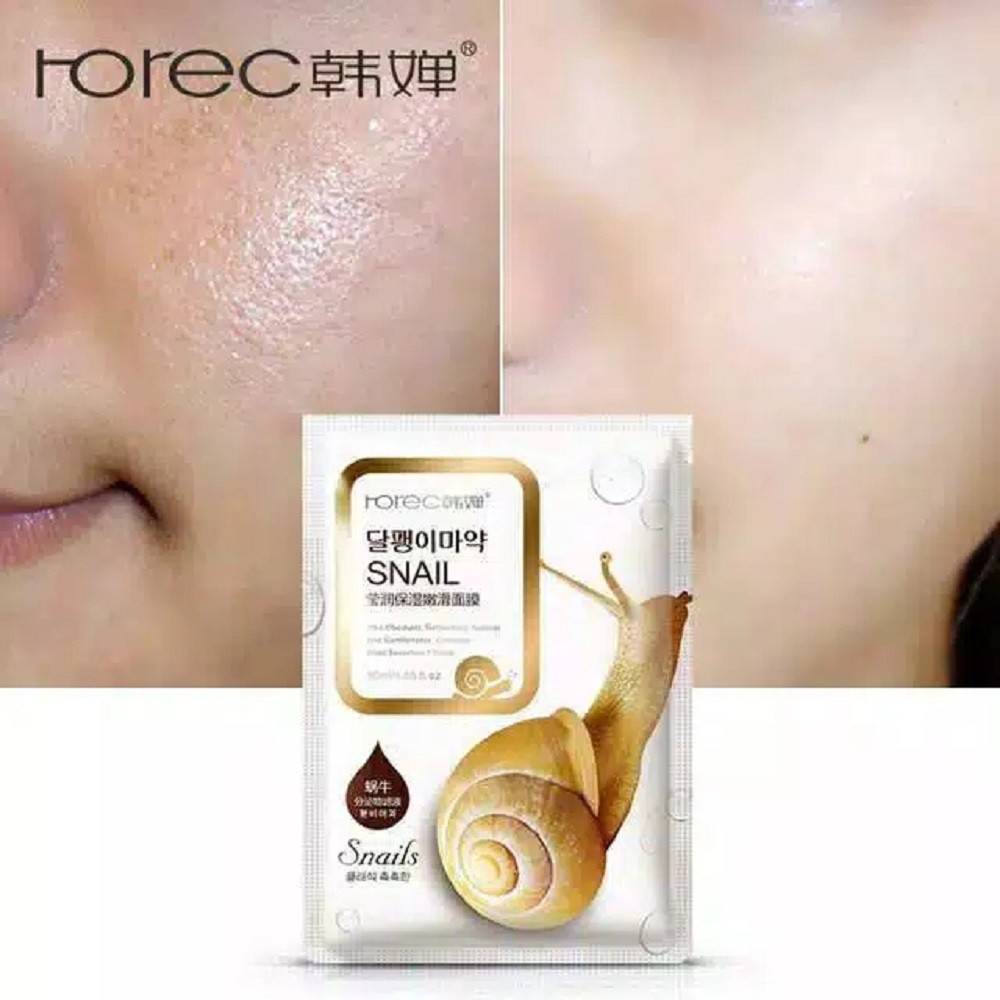 ROREC HCHANA Snail Sheet Mask