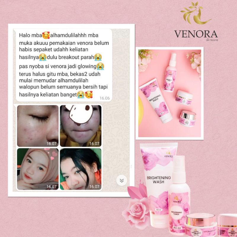 [TERLARIS] FACIAL FOAM VENORA SABUN CUCI MUKA TERLARIS BIKIN WAJAH BERSIH DARI KOTORAN BIKIN GLOWING CERAH PUTIH DAN HALUS