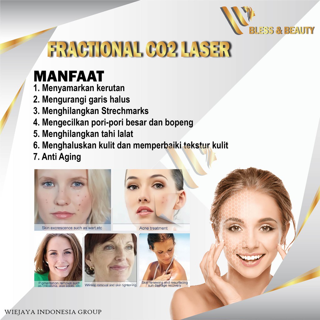 Promo Co2 Fractional Laser Fotona Penghilang Bopeng Scar Bekas Luka Stretchmark Garansi Service Shopee Indonesia
