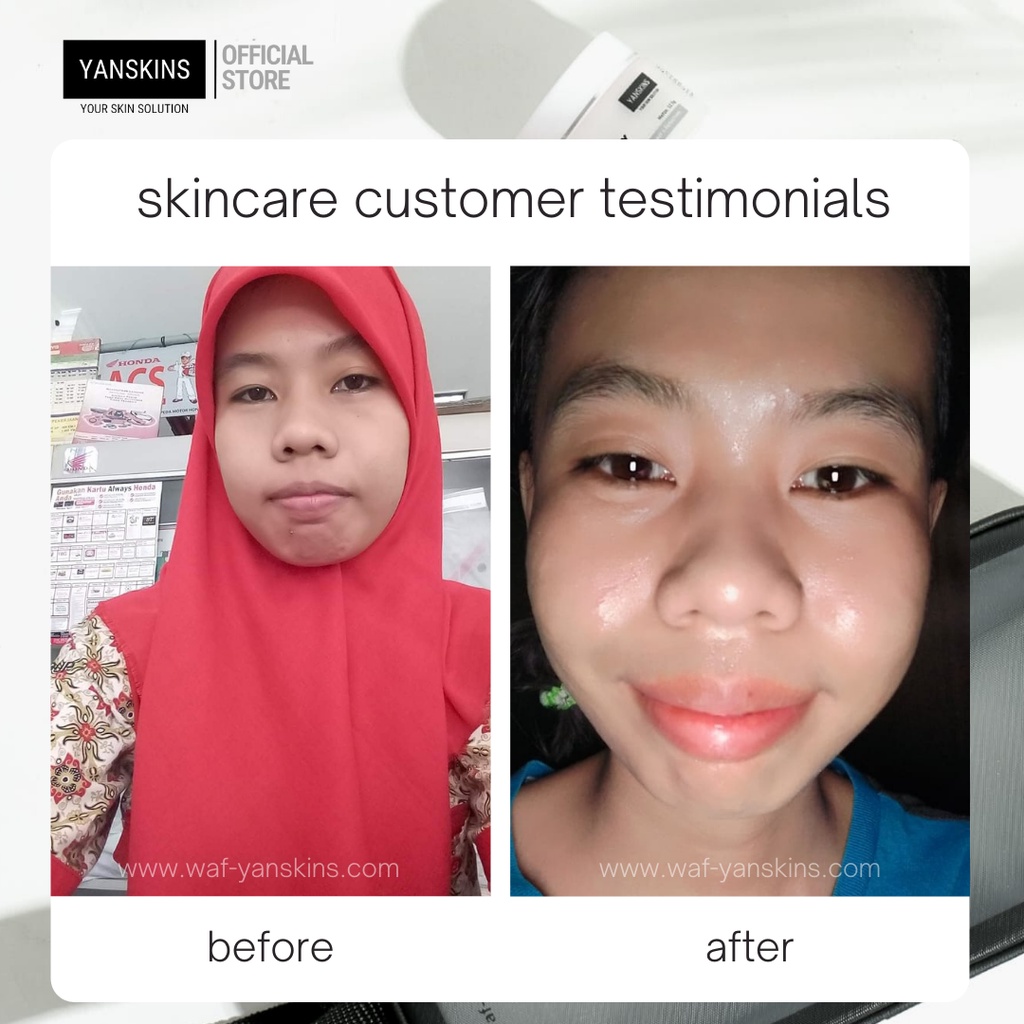 PAKET 6 ITEM SKINCARE BPOM BRIGHTENING SERIES SKIN CARE VARIAN PAKET ACNE FLEK DAN GLOW YANSKINS-6