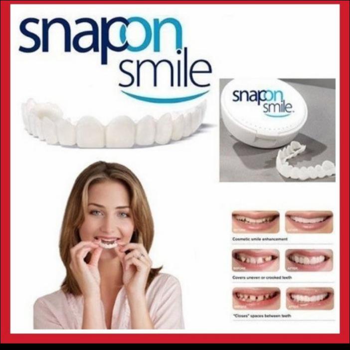 PERFECT SMILE SNAP ON SMILE / GIGI PALSU SNAP ON INSTAN SEPASANG - PAKAI BOX