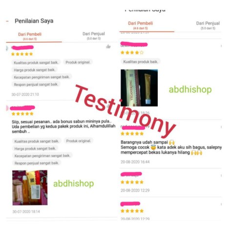 Yiganerjing Obat Gatal Jamur Salep Eksim Yiganerjing Dermatitis Salep Cream Herbal Gatal Kulit