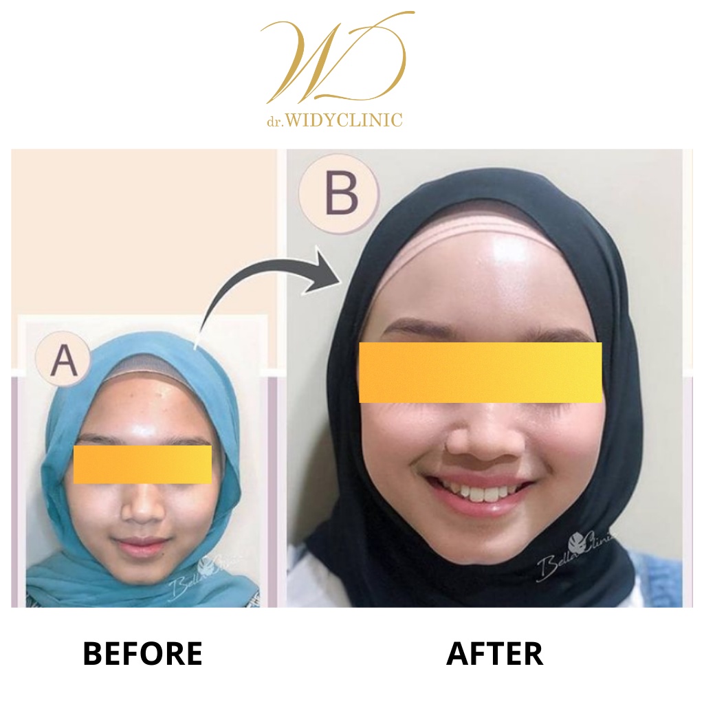 Whitening Night Cream dr Widy Clinic Krim Malam Wajah Glowing Mencerahkan Memutihkan Wajah BPOM Halal MUI Cream Flek Melasma Bekas Jerawat Untuk Semua Jenis Kulit Formulasi Dokter