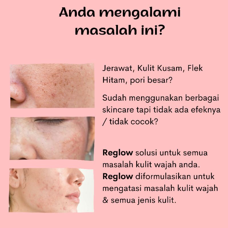 [ Free Gift &amp; Open Reseller ] Reglow SkinTreathment by Dokter Shindy Putri cream hempas jerawat dan buat glowing