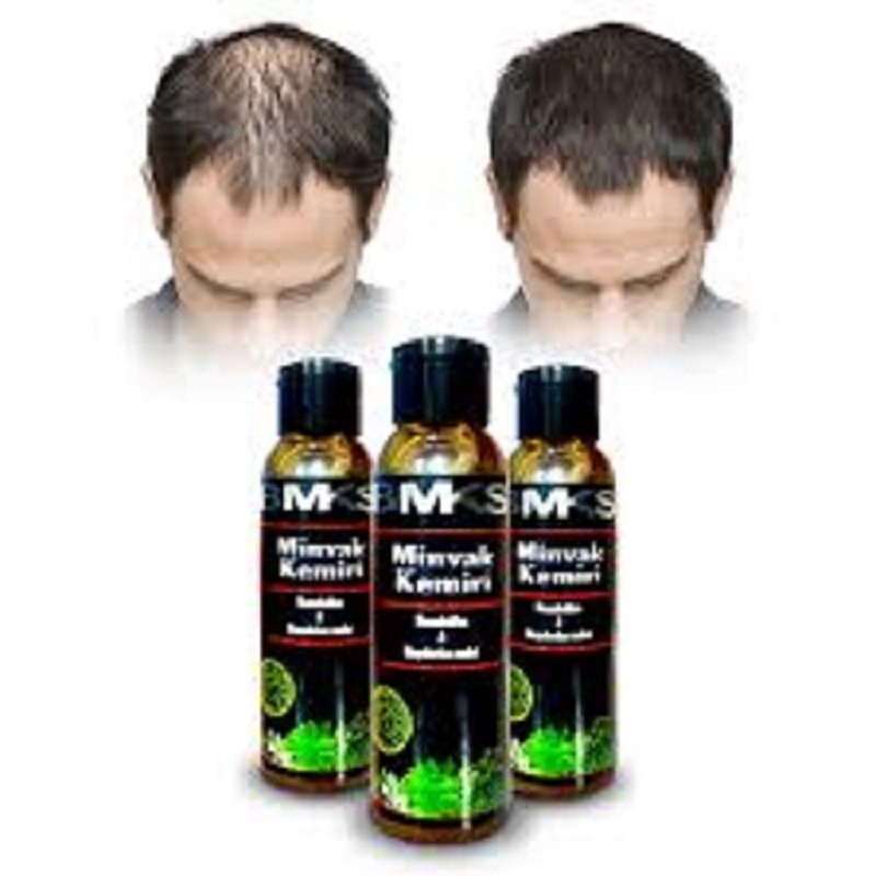 Penumbuh Rambut Minyak Kemiri BMKS Natural BPOM Original - Black Magic Kemiri