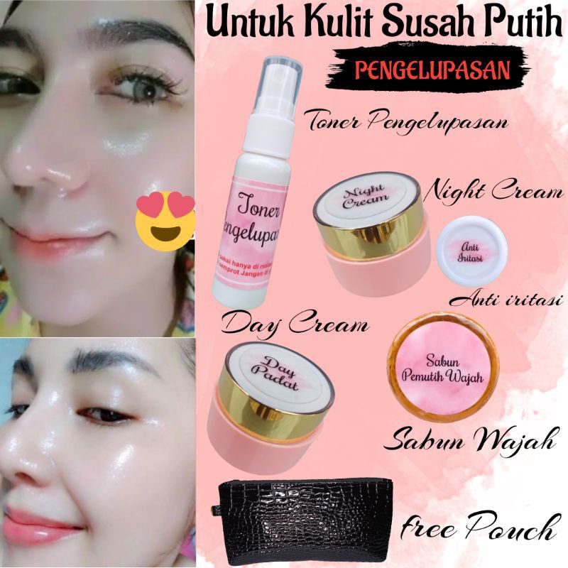 Cream Pemutih Wajah Pengelupasan/Cream Wajah Dosis Tinggi