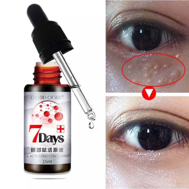 PENGHILANG MILIA BINTIK BINTIL MATA 7DAYS EYE SERUM / 7 HARI PENGHILANGKAN MATA PANDA KERUTAN GARIS HALUS LINGKARAN HITAM-15ml