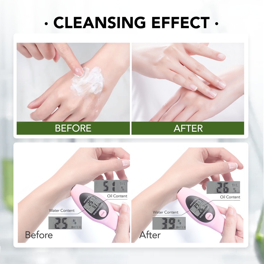 Y.O.U ACNEPLUS Low pH Calming Cleanser - 100gr