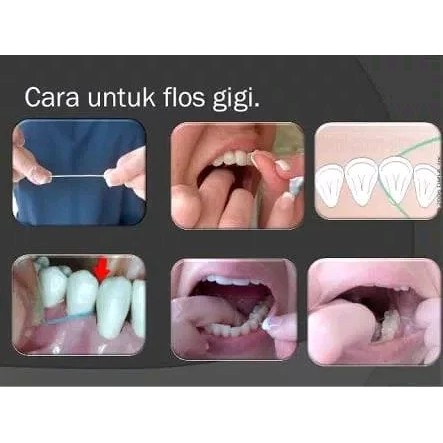 Dental Floss Roll 15m 15 meter . Benang Gigi Gantungan Kunci . pembersih sela sela plak di gigi sikat interdental . behel dental behelldental ortho