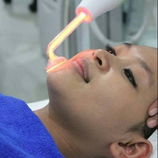 Alat Facial Jerawat Portable HF